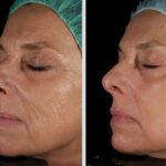 30% OFF YOUR FIRST LASER SESSION & 15% OFF ALL PACKAGES