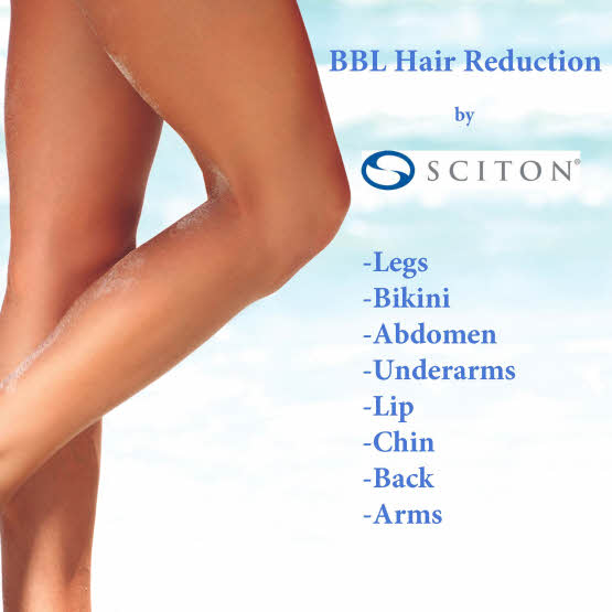 Laser Hair Removal with BBL