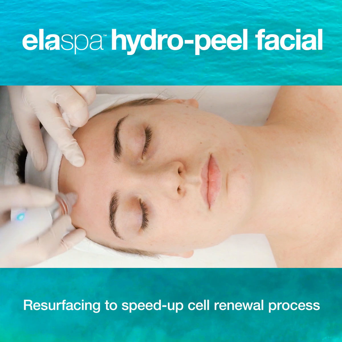 elaspa-hydro-peel-facial-1-3